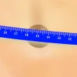 Phimosis Stretches Phimosis Stretches