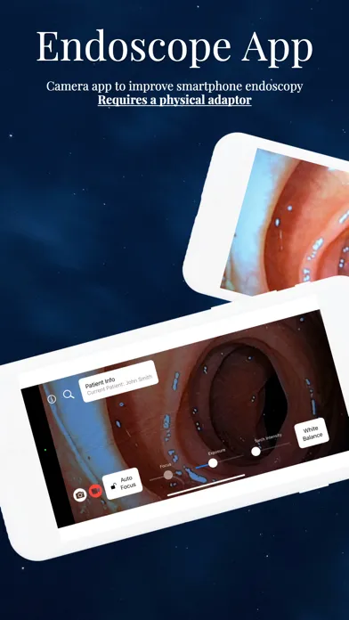 Endoscope App سکرین شاٹس