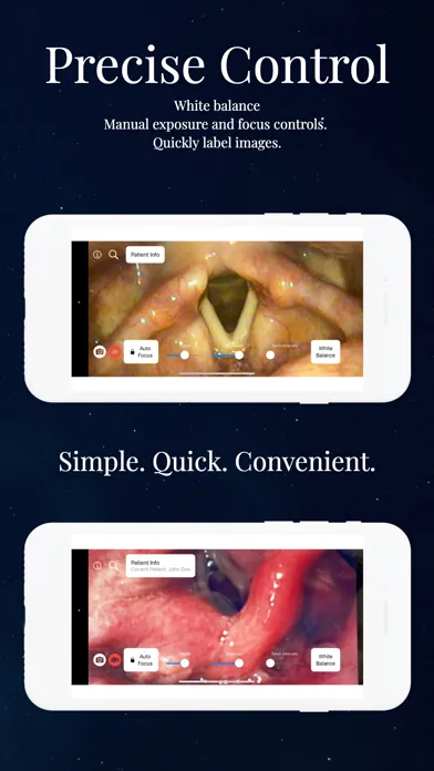 Endoscope App سکرین شاٹس