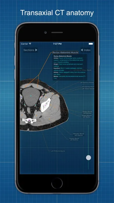 صور X-Anatomy Basic
