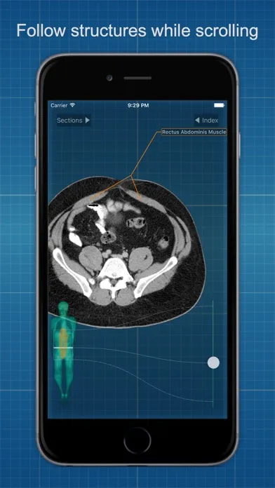 صور X-Anatomy Basic