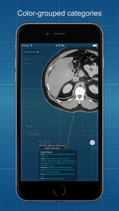 صور X-Anatomy Basic