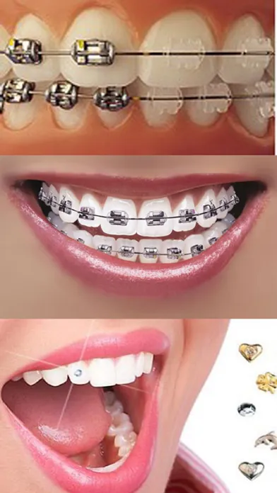 Orthodontic应用截图