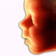 ScanBaby learn baby ultrasound ScanBaby learn baby ultrasound