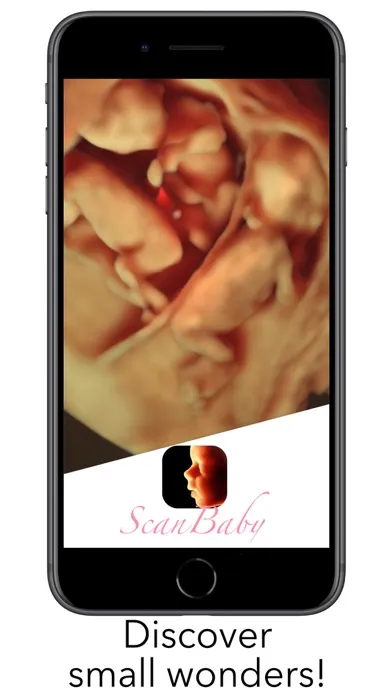 ScanBaby learn baby ultrasound স্ক্রিনশট
