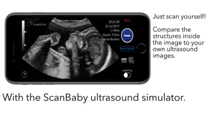 ScanBaby learn baby ultrasound স্ক্রিনশট