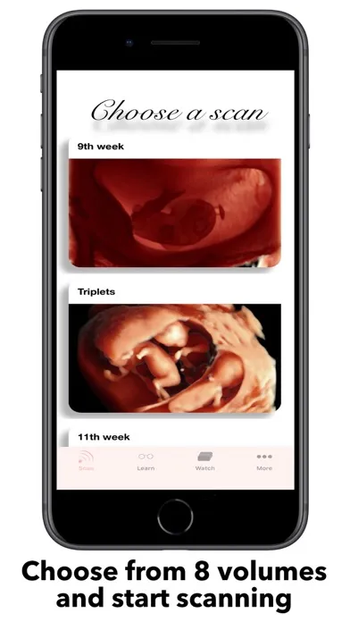ScanBaby learn baby ultrasound স্ক্রিনশট