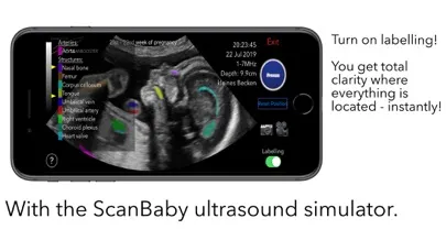 ScanBaby learn baby ultrasound স্ক্রিনশট