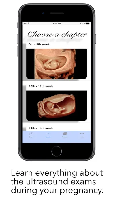 ScanBaby learn baby ultrasound স্ক্রিনশট