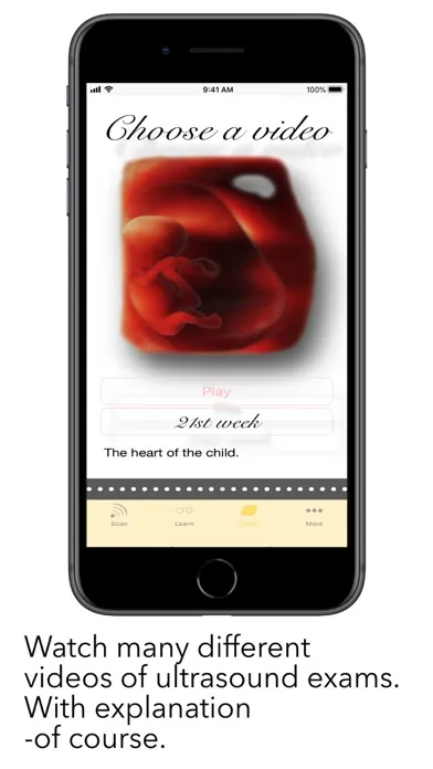 ScanBaby learn baby ultrasound স্ক্রিনশট