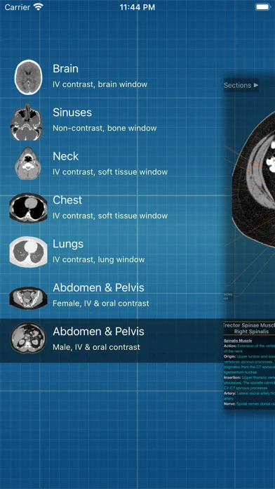 Captures d'écran de X-Anatomy Pro