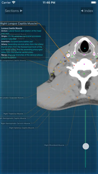 Captures d'écran de X-Anatomy Pro