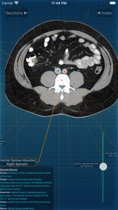 Captures d'écran de X-Anatomy Pro