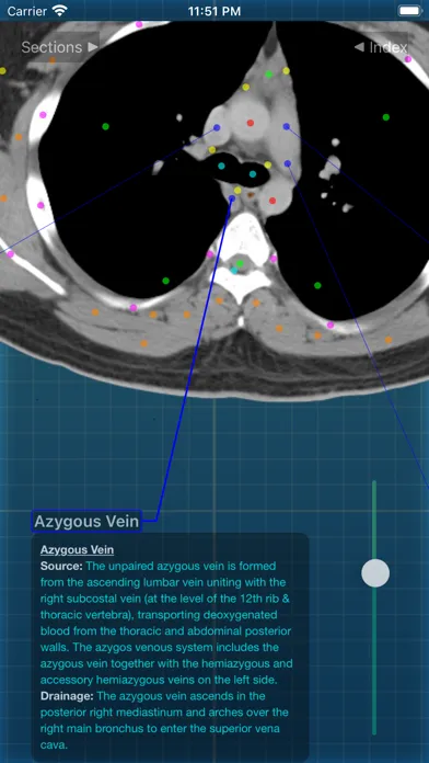 Captures d'écran de X-Anatomy Pro