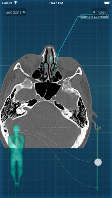 Captures d'écran de X-Anatomy Pro