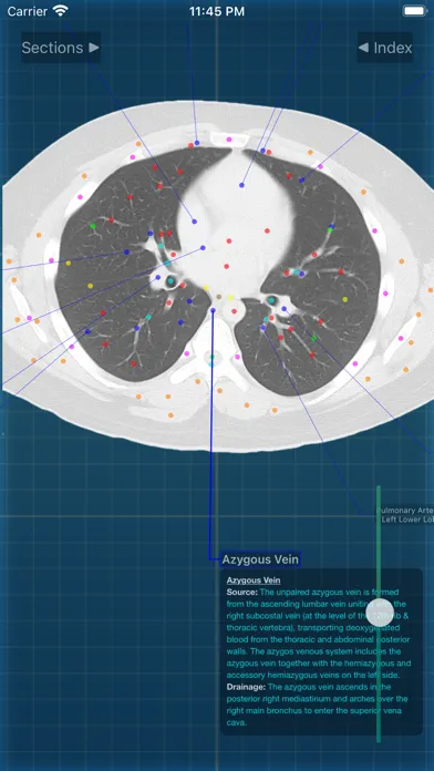 Captures d'écran de X-Anatomy Pro