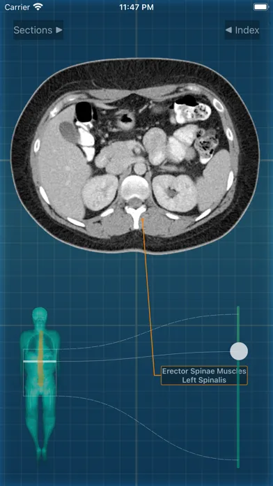 Captures d'écran de X-Anatomy Pro