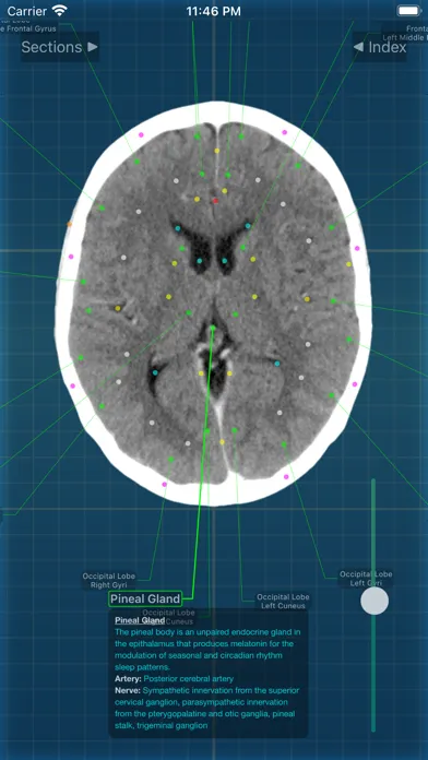 Captures d'écran de X-Anatomy Pro