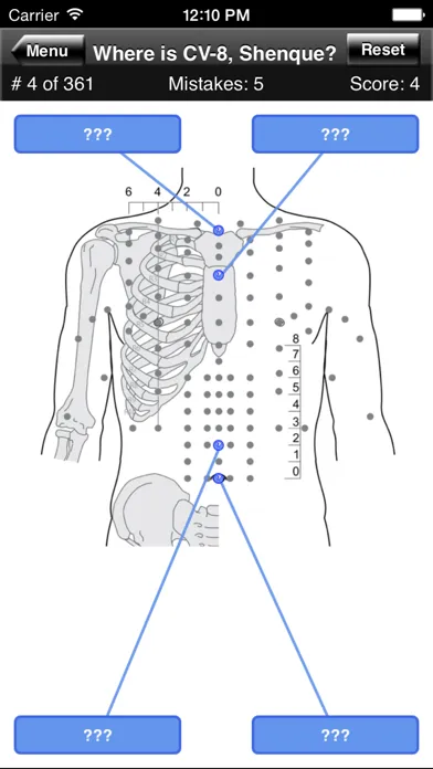 Capturas de pantalla de Acupuncture Points Body Quiz