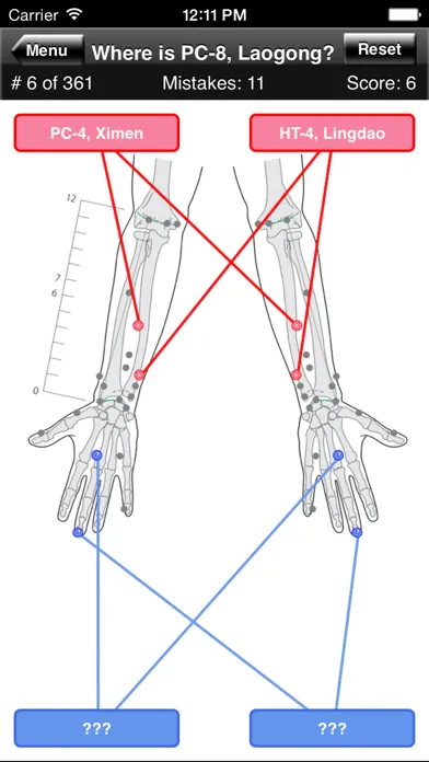 Capturas de pantalla de Acupuncture Points Body Quiz