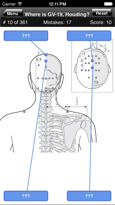 Capturas de pantalla de Acupuncture Points Body Quiz