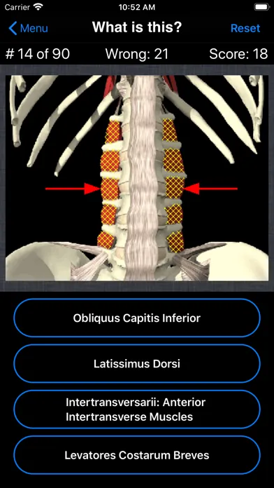 Tangkapan layar Anatomy Spine Quiz