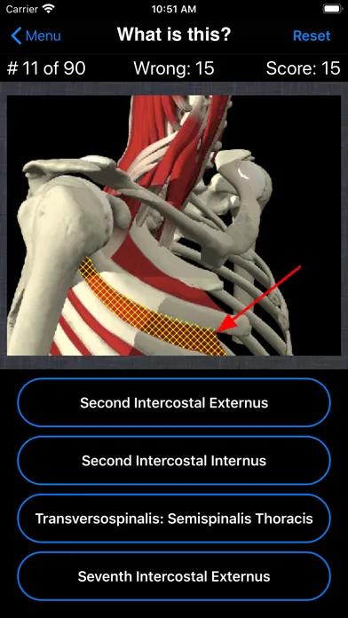 Tangkapan layar Anatomy Spine Quiz