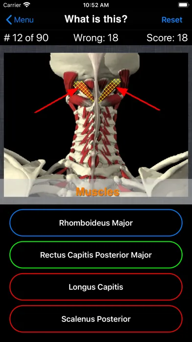 Tangkapan layar Anatomy Spine Quiz