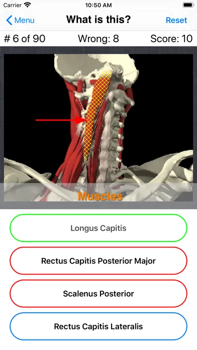Tangkapan layar Anatomy Spine Quiz