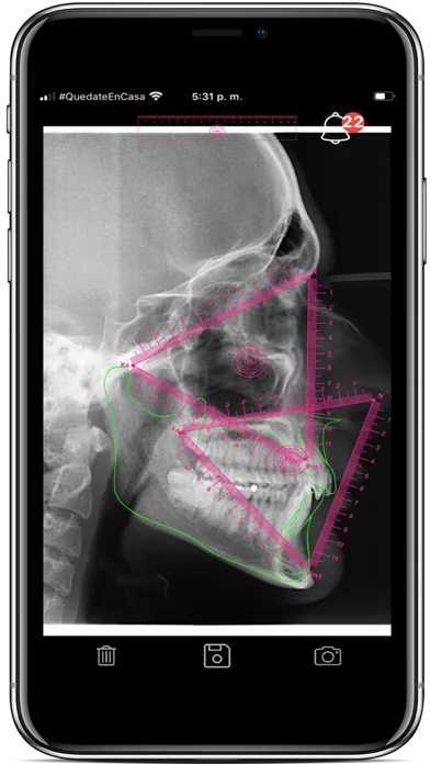 Captures d'écran de CEPH APP  By ORTHOKINETIC APPS