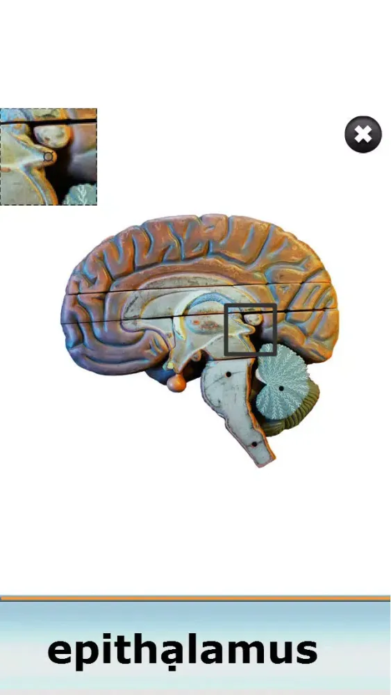 Anatomy Star - CNS (the Brain) Screenshots