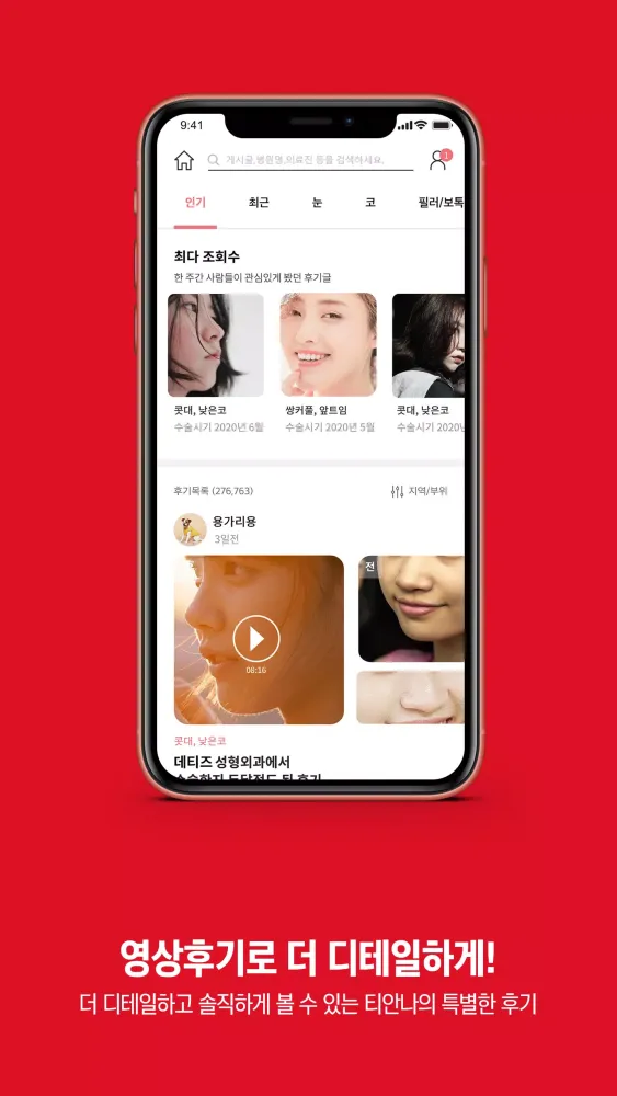 Zrzuty ekranu 티안나 - 시술후기 성형외과 어플 성형견적