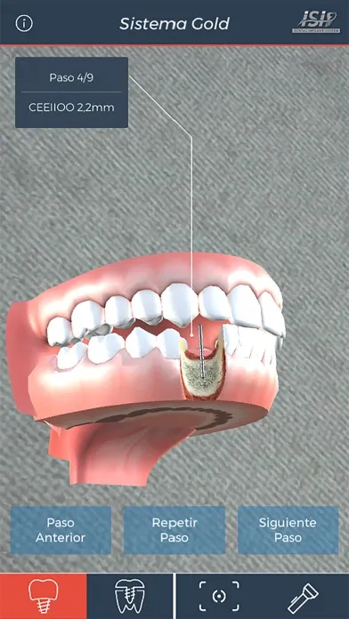 ISI Dental Ekran Görüntüleri