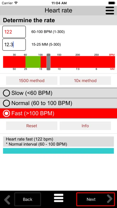 Tangkapan skrin ECG Calc Lite