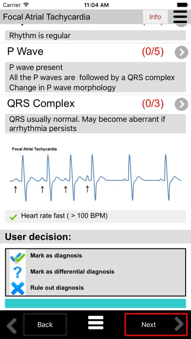 Tangkapan skrin ECG Calc Lite