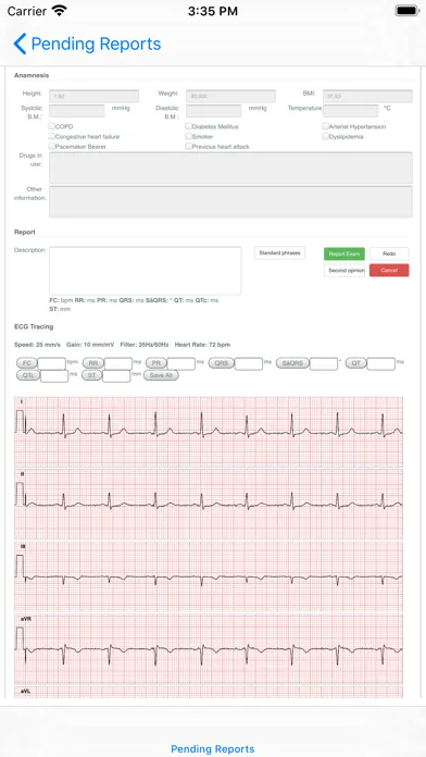 Capturas de pantalla de Web ECG Reports