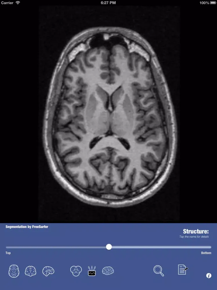Скриншоты iSurf BrainView iPad 