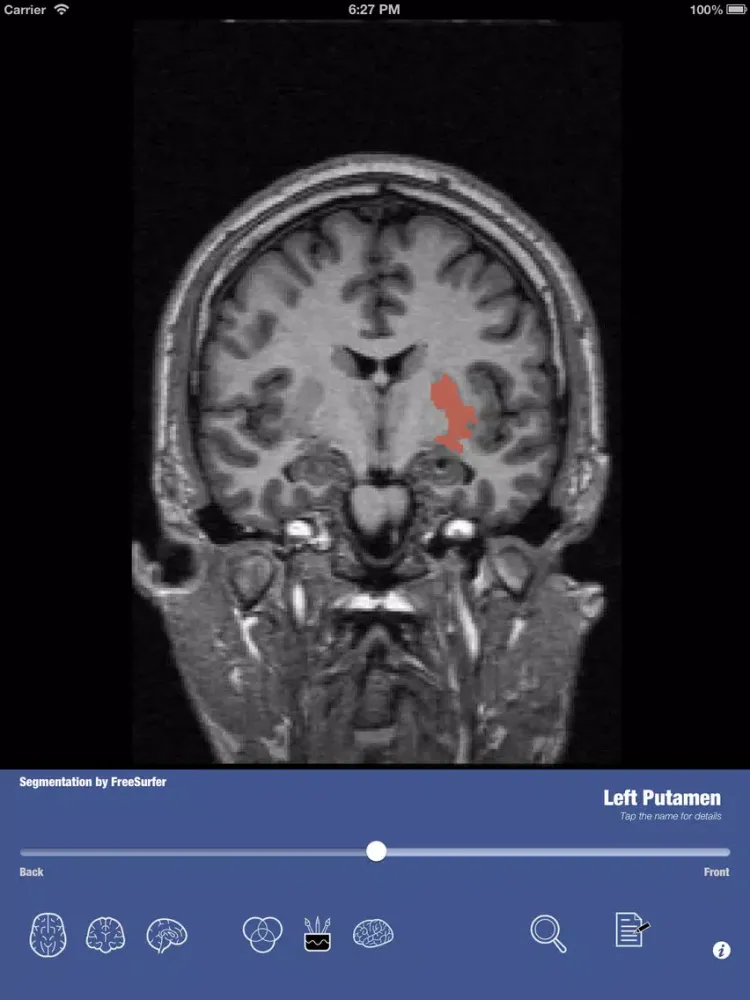 Скриншоты iSurf BrainView iPad 
