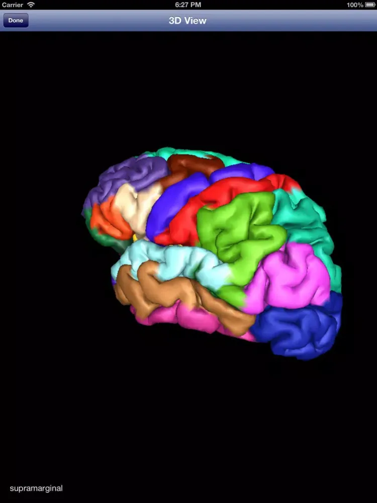 Скриншоты iSurf BrainView iPad 