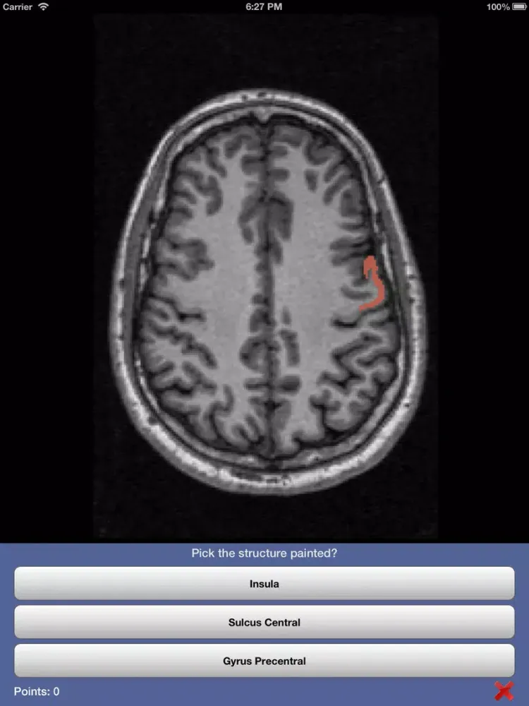 Скриншоты iSurf BrainView iPad 