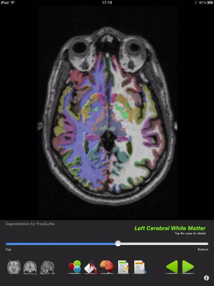 Скриншоты iSurf BrainView iPad 