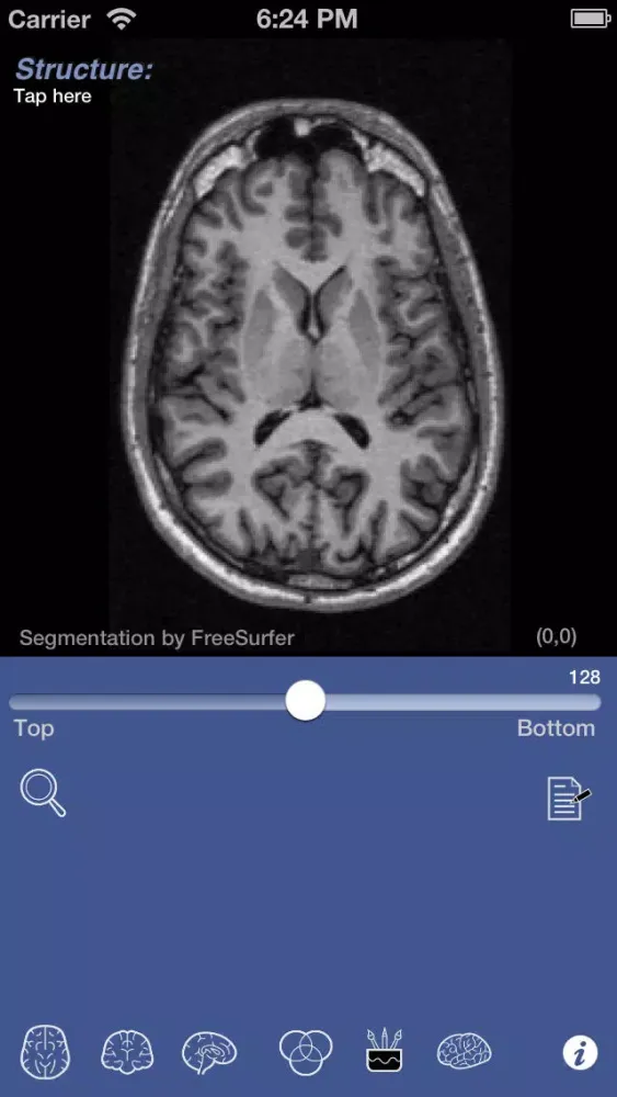 Скриншоты iSurf BrainView