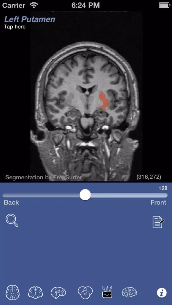 Скриншоты iSurf BrainView