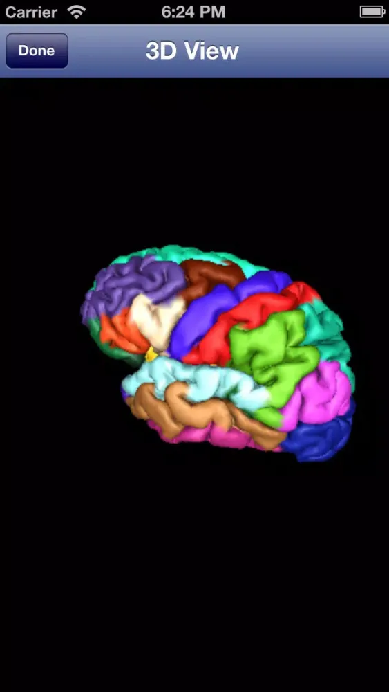 Скриншоты iSurf BrainView