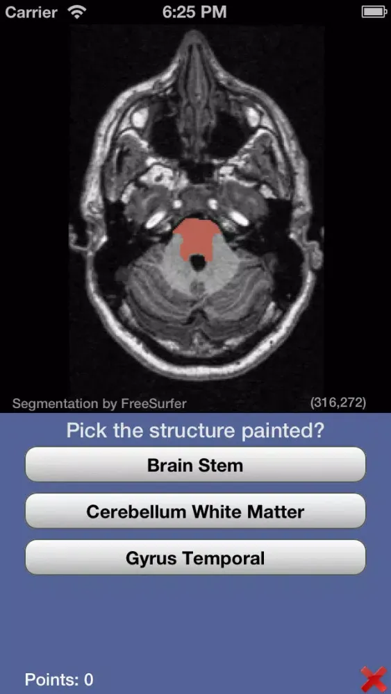 Скриншоты iSurf BrainView