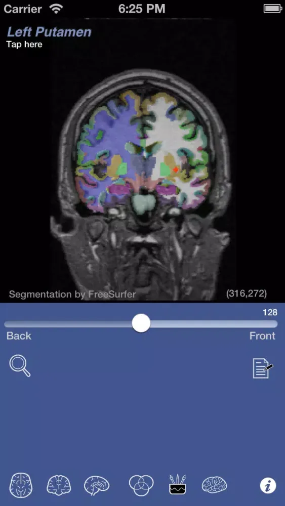 Скриншоты iSurf BrainView
