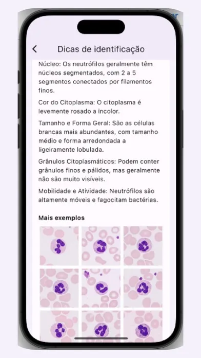 Capturas de pantalla de Leucogram | wbc counter