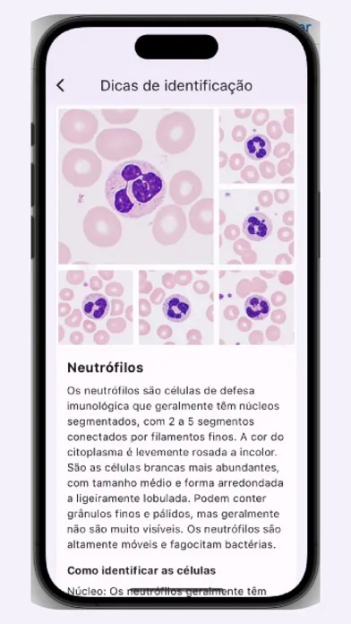 Capturas de pantalla de Leucogram | wbc counter