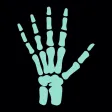 DIAX - Bone Age