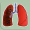 DPOC - Doença Pulmonar Obstrutiva Crônica - TelessaúdeRS